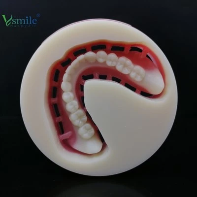 KHỐI PMMA đầy đủ răng giả